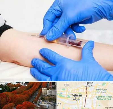 آزمایشگاه ازدواج در ولیعصر 