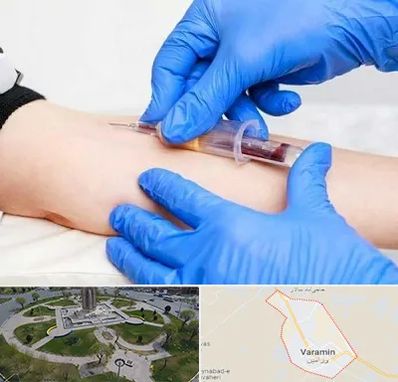 آزمایشگاه ازدواج در ورامین