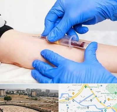 آزمایشگاه ازدواج در کوی وحدت شیراز