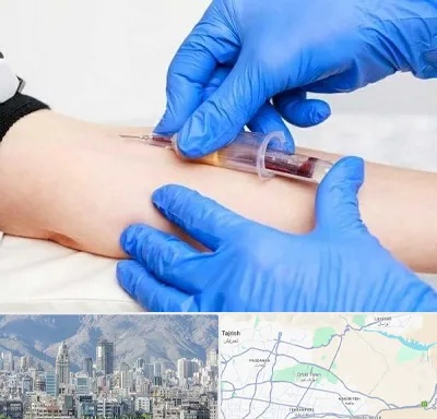 آزمایشگاه ازدواج در شمال شرق تهران