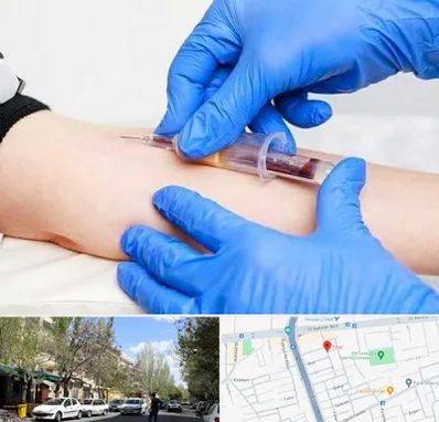 آزمایشگاه ازدواج در کوی فیروز تبریز