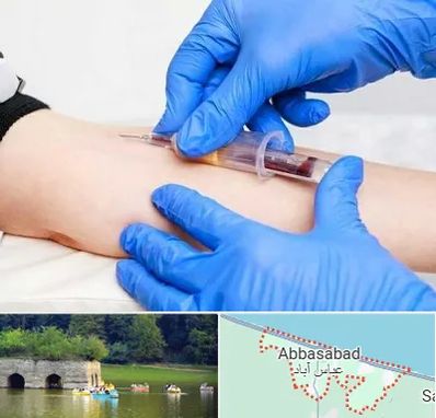 آزمایشگاه ازدواج در عباس آباد