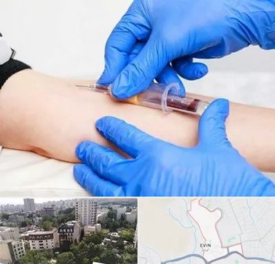 آزمایشگاه ازدواج در اوین