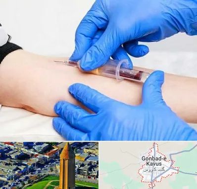 آزمایشگاه ازدواج در گنبد کاووس