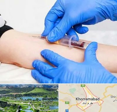 آزمایشگاه ازدواج در خرم آباد