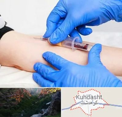 آزمایشگاه ازدواج در کوهدشت