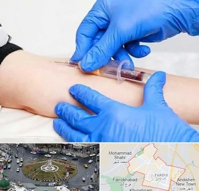 آزمایشگاه ازدواج در فردیس کرج 