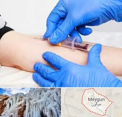 آزمایشگاه ازدواج در میگون