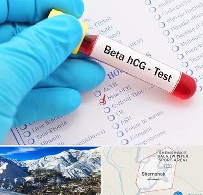 آزمایشگاه بارداری در شمشک
