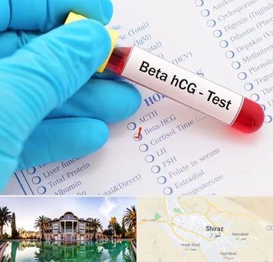 آزمایشگاه بارداری در شیراز