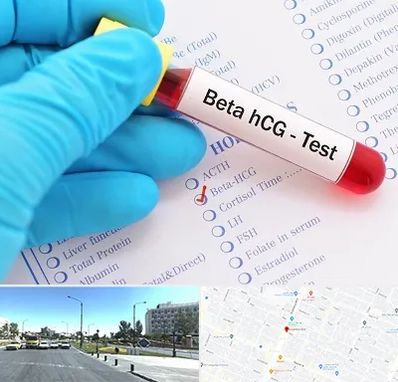 آزمایشگاه بارداری در بلوار کلاهدوز مشهد