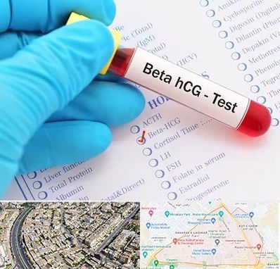 آزمایشگاه بارداری در شهرک غرب مشهد