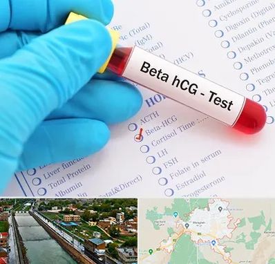 آزمایشگاه بارداری در مراغه