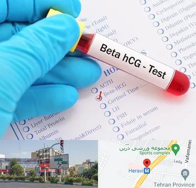 آزمایشگاه بارداری در هروی 