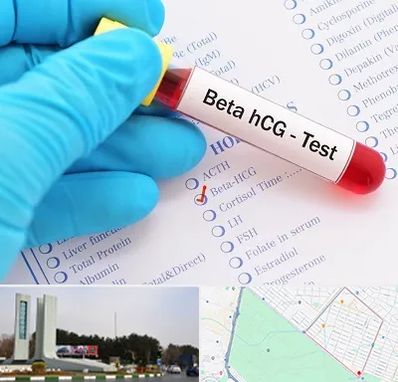 آزمایشگاه بارداری در بلوار فلسیطین مشهد