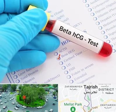 آزمایشگاه بارداری در تجریش 