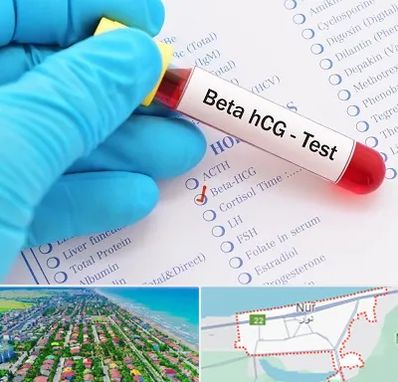 آزمایشگاه بارداری در نور