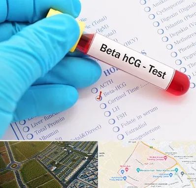 آزمایشگاه بارداری در الهیه مشهد
