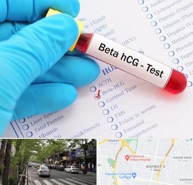 آزمایشگاه بارداری در ظفر 