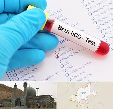 آزمایشگاه بارداری در شهرضا