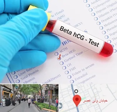 آزمایشگاه بارداری در ولیعصر شهریار