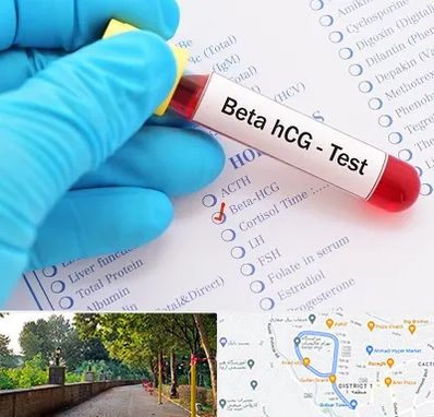 آزمایشگاه بارداری در فلکه گاز رشت