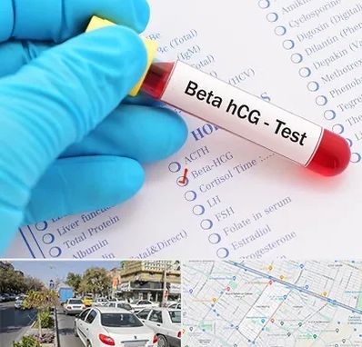 آزمایشگاه بارداری در مفتح مشهد