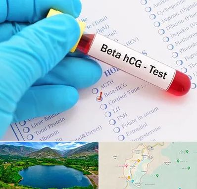 آزمایشگاه بارداری در رودبار