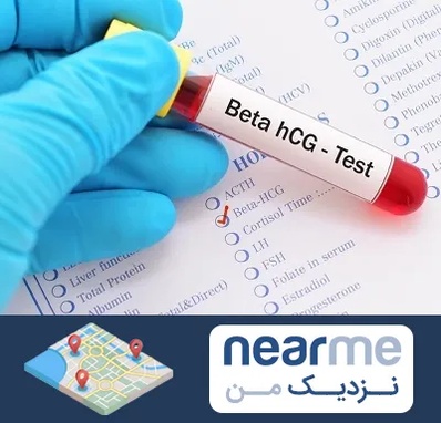 آزمایشگاه بارداری در نزدیک من