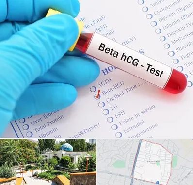 آزمایشگاه بارداری در باغمیشه تبریز