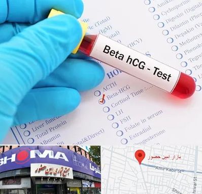 آزمایشگاه بارداری در امین حضور