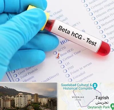 آزمایشگاه بارداری در زعفرانیه 