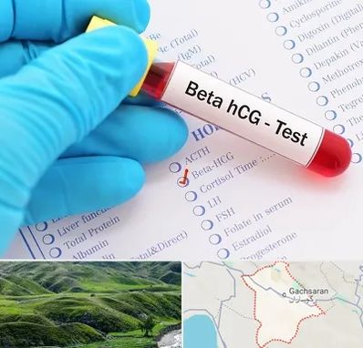 آزمایشگاه بارداری در گچساران