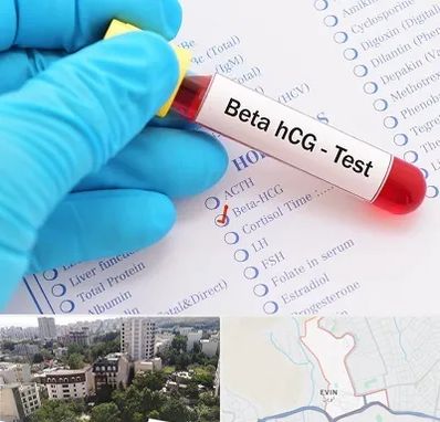 آزمایشگاه بارداری در اوین