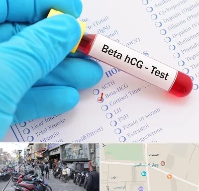 آزمایشگاه بارداری در چهارراه استانبول