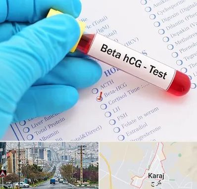 آزمایشگاه بارداری در گوهردشت کرج 