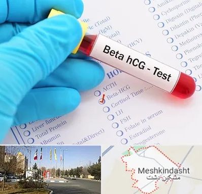 آزمایشگاه بارداری در مشکین دشت