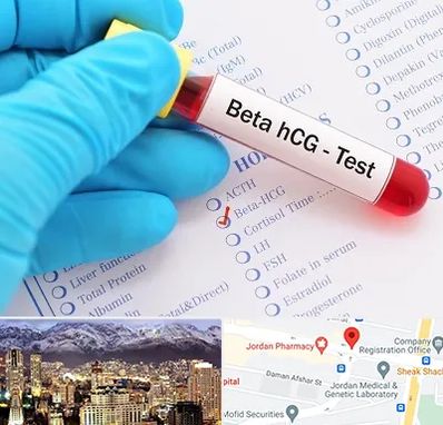 آزمایشگاه بارداری در جردن 