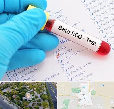 آزمایشگاه بارداری در کاشمر