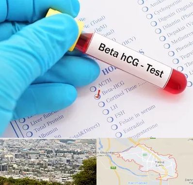 آزمایشگاه بارداری در یاسوج