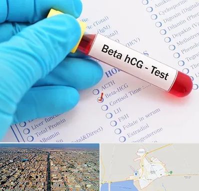 آزمایشگاه بارداری در بندر ماهشهر