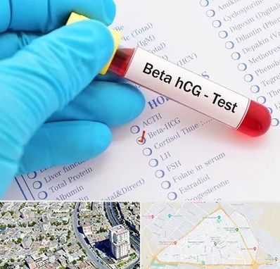 آزمایشگاه بارداری در قاسم آباد مشهد