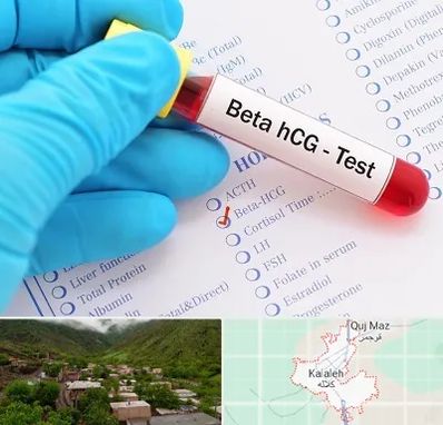 آزمایشگاه بارداری در کلاله