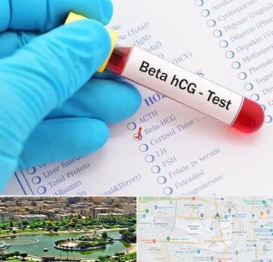 آزمایشگاه بارداری در منطقه 9 تهران 