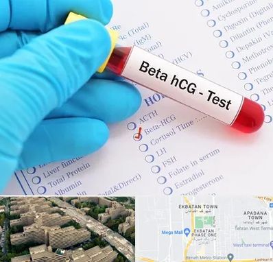 آزمایشگاه بارداری در اکباتان 