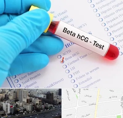 آزمایشگاه بارداری در زرتشت