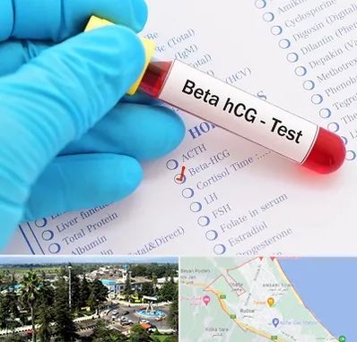 آزمایشگاه بارداری در رودسر