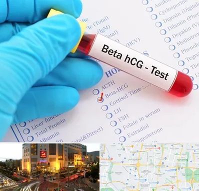 آزمایشگاه بارداری در جنت آباد تهران 