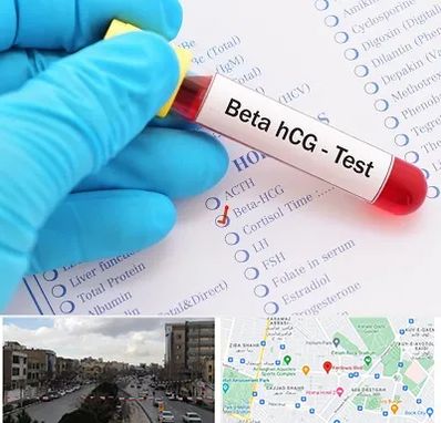 آزمایشگاه بارداری در بلوار فردوسی مشهد