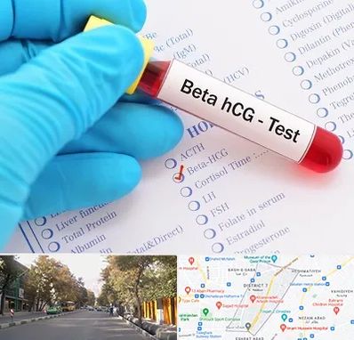 آزمایشگاه بارداری در شریعتی 